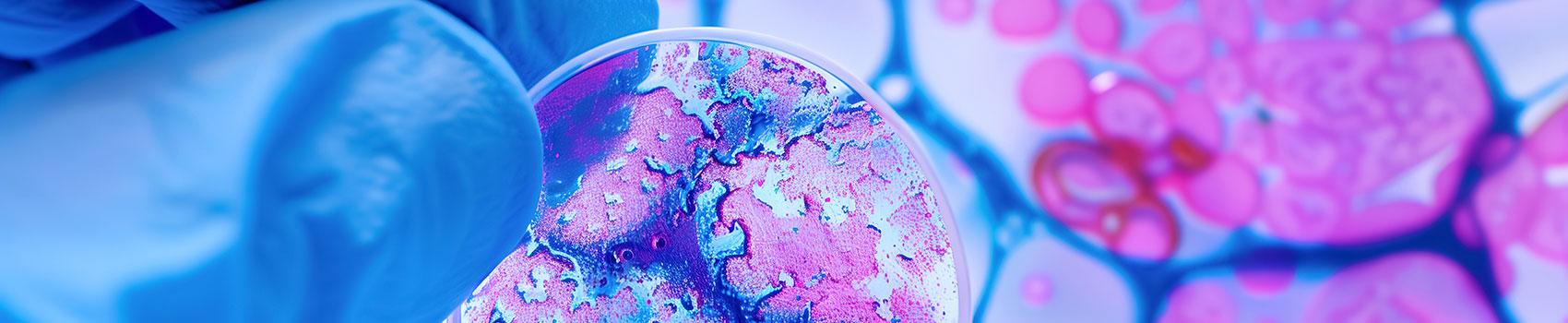 Close up of vivid coloured cancer cells in blue and pink on a slide under a microscope